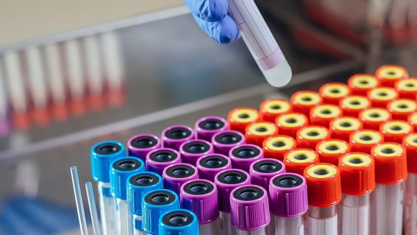 Επιπλέον 15 εκατ. ευρώ στον ΕΟΠΥΥ για αξονικές, μαγνητικές και PET/CT