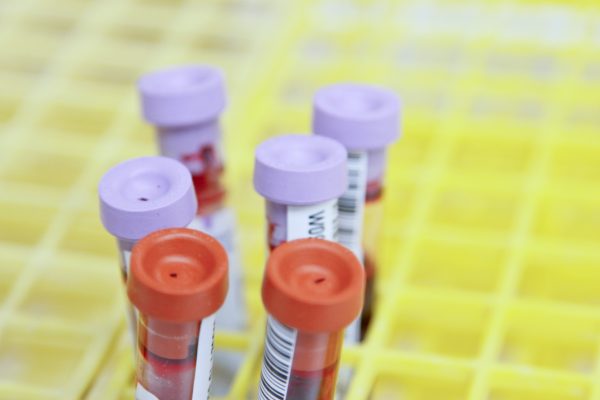 Αιμοδοσία: Συνεχίζεται ακόμα το στίγμα προς τα άτομα που εργάζονται στο σεξ;
