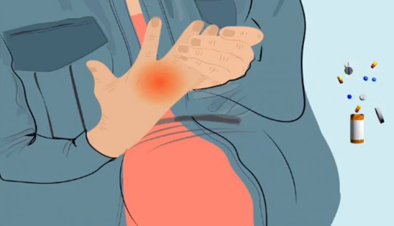 Προγραμματισμός της εγκυμοσύνης σε ασθενείς με αυτοάνοσα νοσήματα