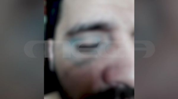 «Σώσε με γιατί με σκοτώνουν» – Άγριος βασανισμός 33χρονου κρατούμενου από αστυνομικούς