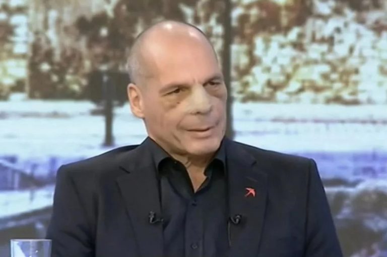 Βαρουφάκης: Πρώτη εμφάνιση μετά τον ξυλοδαρμό – «Η μύτη είναι σπασμένη σε έξι σημεία», η απαίτηση της συζύγου του