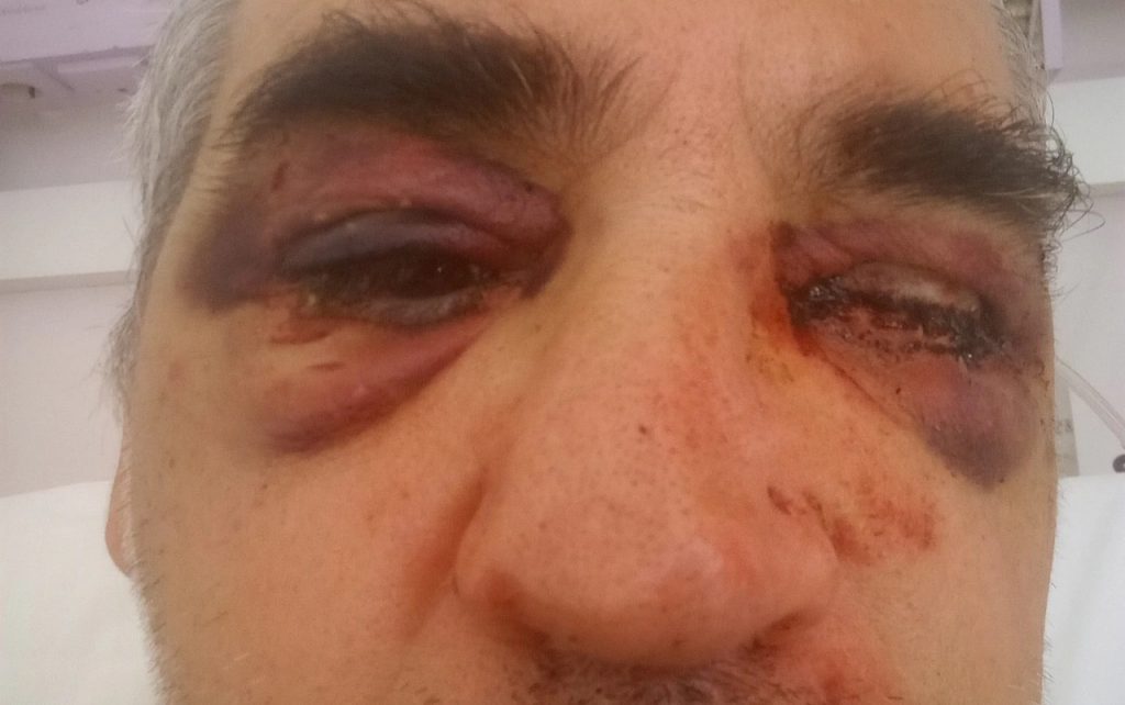 Σοκάρει η πρώτη εικόνα του αρχαιολόγου που έπεσε θύμα ξυλοδαρμού – Τι αποκάλυψε στην Telegraph