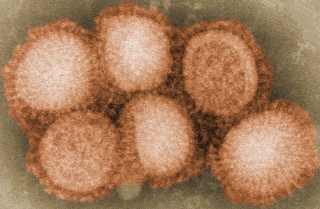 Η Όμικρον πιο θανατηφόρα από την εποχική γρίπη για όσους νοσηλεύονται