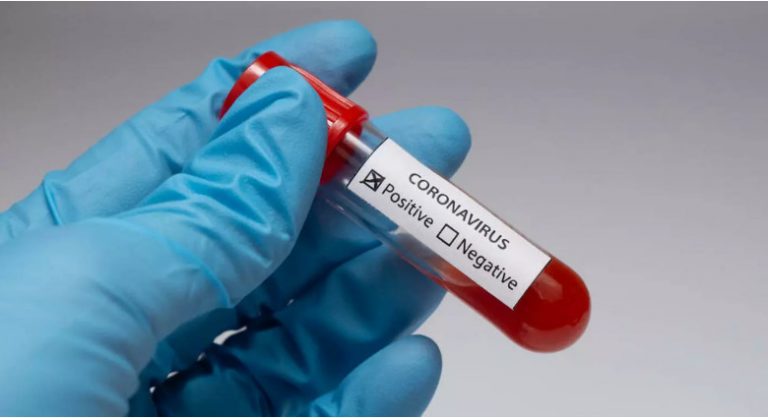 ΕΟΔΥ: 44 θάνατοι από τον κοροναϊό και 69 διασωληνωμένοι την τελευταία εβδομάδα