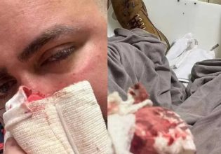 Ομοφοβική επίθεση στην Αυστραλία: «Με ρώτησε αν είμαι γκέι και ξαφνικά άρχισε να με βαράει»