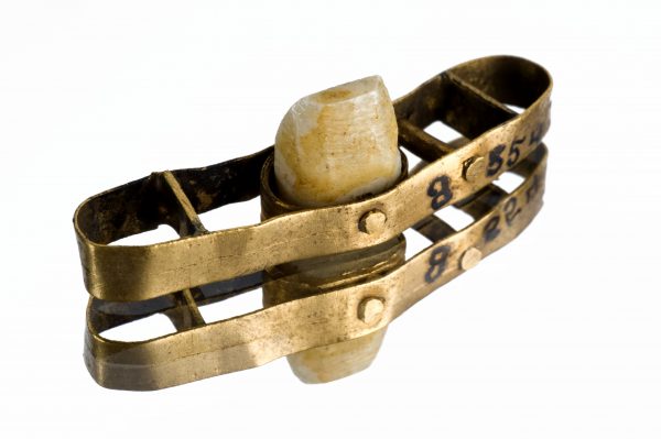 Αλλόκοτη ανακάλυψη: Γιατί οι αρχαίοι Ρωμαίοι είχαν πιο υγιή δόντια από ό,τι εμείς σήμερα