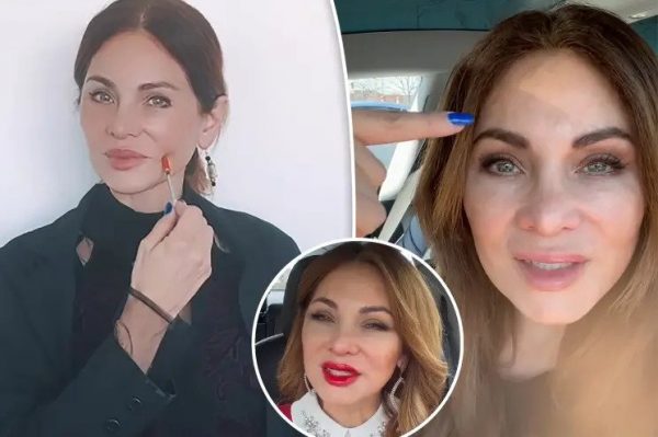 TikTok: Έκανε μπότοξ στο πρόσωπο για 20 χρόνια και δείχνει πώς είναι τώρα που σταμάτησε