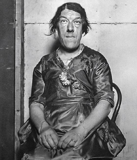 Μια σπουδαία μητέρα που έμεινε στην ιστορία ως η «πιο άσχημη γυναίκα του κόσμου»