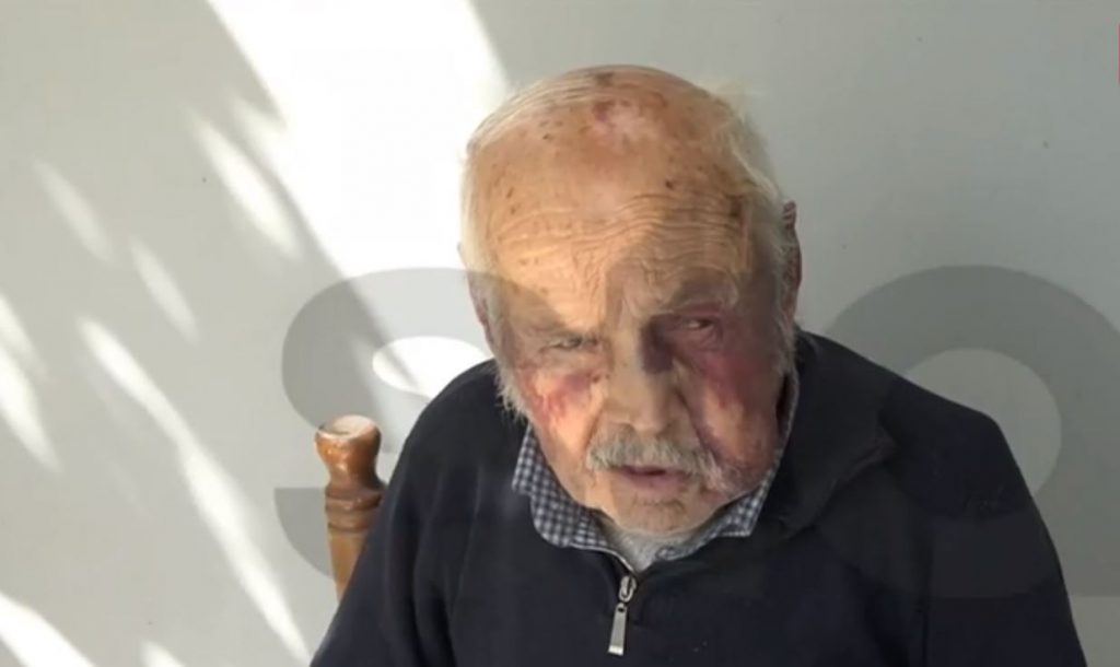 Χαλκίδα: Συγκλονίζει ο 90χρονος που τον ξυλοκόπησαν ληστές για 80 ευρώ