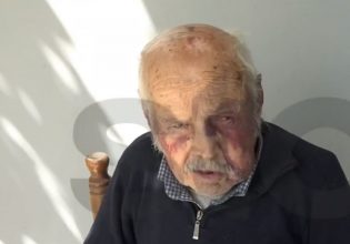 Χαλκίδα: Συγκλονίζει ο 90χρονος που τον ξυλοκόπησαν ληστές για 80 ευρώ