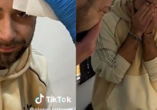 Άνδρας έκανε τατουάζ φράντζα για να «κρύψει» τη φαλάκρα του – Έμεινε άφωνος με το αποτέλεσμα