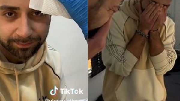 Άνδρας έκανε τατουάζ φράντζα για να «κρύψει» τη φαλάκρα του – Έμεινε άφωνος με το αποτέλεσμα