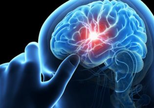 Εγκεφαλικό: Οι θάνατοι αναμένεται να φτάσουν τα πέντε εκατομμύρια ως το 2030