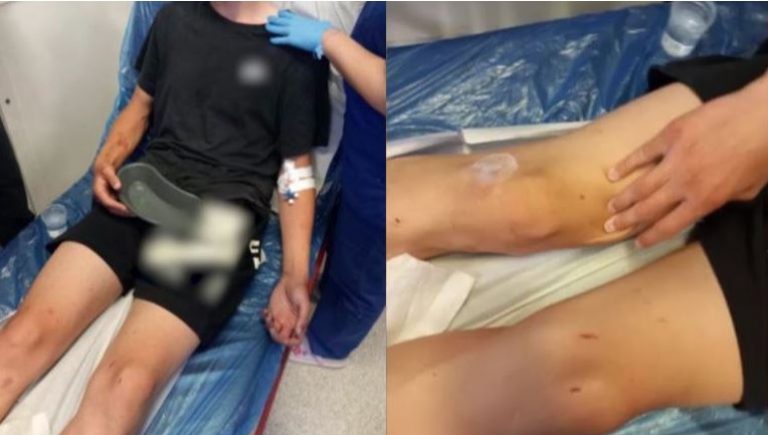 Καλαμάτα: «Πήγε να ζητήσει συγγνώμη και τον έσερναν στο δρόμο» – Συγκλονίζει η μητέρα του ενός ανήλικου