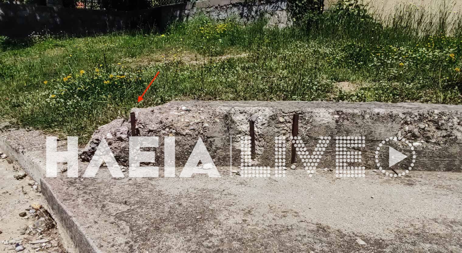 Ατύχημα σε παιδική χαρά: 5χρονη με κάταγμα κρανίου στην Αρχαία Ολυμπία - Παραλίγο να χάσει το μάτι της