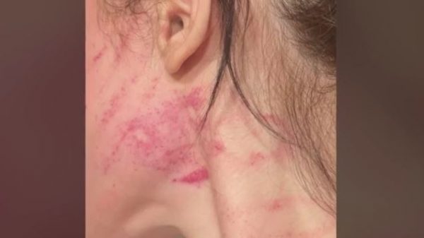 Ενδοοικογενειακή βία: Ζήτησε από το σύντροφό της να χωρίσουν και την έσπασε στο ξύλο