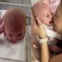 Νεογέννητο μωρό… θαύμα: Είναι τριών ημερών και συμπεριφέρεται σαν τριών μηνών