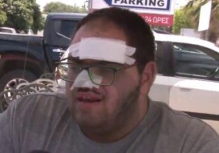 Γεωργιάδης: Παρέμβαση μετά την καταγγελία μάγειρα πως κάηκε με λάδι και τον έβαλαν σε ψυγείο με κρέατα