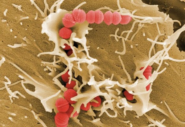 Στρεπτόκοκκος – Παγώνη: Πώς μεταδίδεται – Σημαντικό να ελεγχθούν τα συμπτώματα τα πρώτα εικοσιτετράωρα