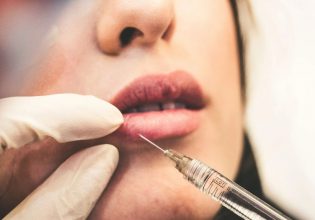 Ποια είναι η 54χρονη που πωλούσε επικίνδυνα botox και μάσκες ομορφιάς σε γιατρούς και κέντρα αισθητικής