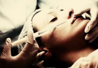 Πληθαίνουν οι ασθενείς με επιπλοκές ύστερα από αμφιβόλου ποιότητας botox