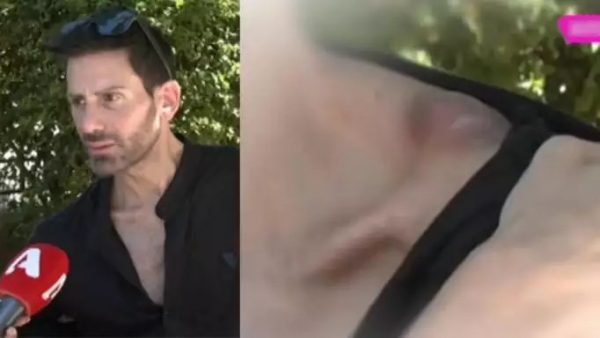 Σοκάρει ο γιος του Γιάννη Φλωρινιώτη μιλώντας για τη μάχη με τον καρκίνο – Το σημάδι στον ώμο από την επέμβαση