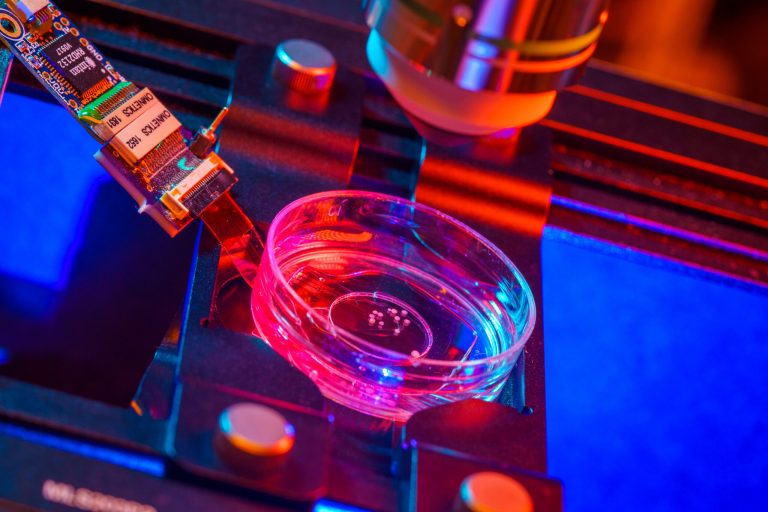 Πάρκινσον: Ενθαρρυντικά αποτελέσματα από θεραπεία βλαστοκυττάρων της Bayer