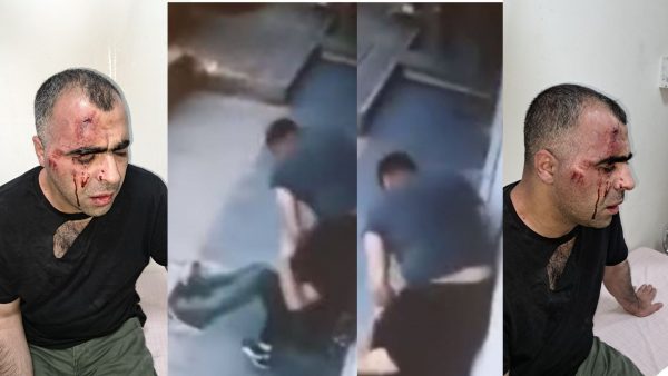 Τουρκία: «Σωματοφύλακες» δημάρχου ξυλοκόπησαν άγρια δημοσιογράφο