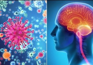 Ύποπτος μύκητας προκαλεί μηνιγγίτιδα στις ΗΠΑ και το Μεξικό