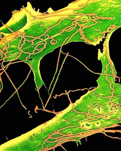 Αυξάνονται τα νοσήματα που μεταδίδονται με το σεξ