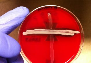 Κινδύνους από το strep-test εκτός ιατρείων δείχνουν οι εργαστηριακοί γιατροί