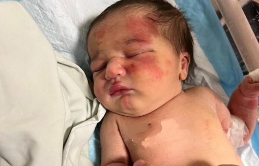 Συγκλονιστική ιστορία στον Λίβανο: Αδέσποτος σκύλος βρήκε στα σκουπίδια μωρό και το έσωσε