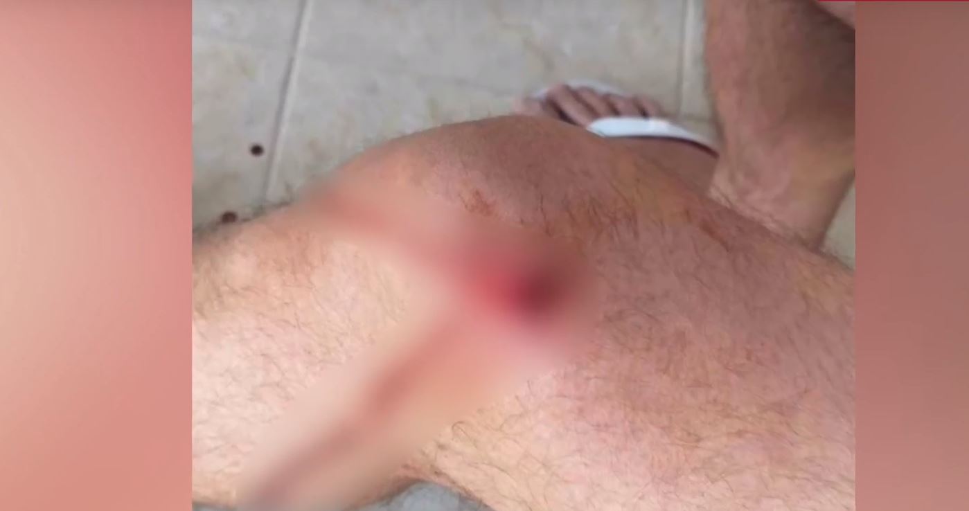Άνω Λιόσια: Βγήκε στο μπαλκόνι για να πιει τον καφέ του και παραλίγο να σκοτωθεί από αδέσποτη σφαίρα