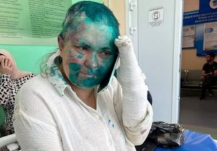 Άγρια επίθεση σε Ρωσίδα δημοσιογράφο – Την κούρεψαν και της έσπασαν τα δάχτυλα