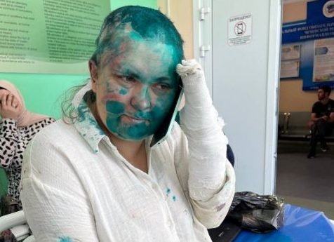 Άγρια επίθεση σε Ρωσίδα δημοσιογράφο – Την κούρεψαν και της έσπασαν τα δάχτυλα