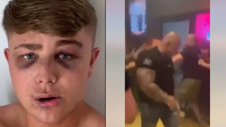 Ζάκυνθος: «Με χτύπησαν επειδή ανέβηκα σε μία καρέκλα» – Τι υποστηρίζει ο Βρετανός τουρίστας για τον άγριο ξυλοδαρμό στον Λαγανά