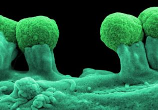 Προβιοτικά και βακτηριοφάγοι ιοί εναντίον ανθεκτικών μικροβίων