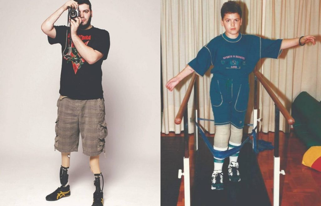 Ο Βασίλης Δοσούλας δίνει μαθήματα ζωής 29 χρόνια μετά το ανατριχιαστικό ατύχημα