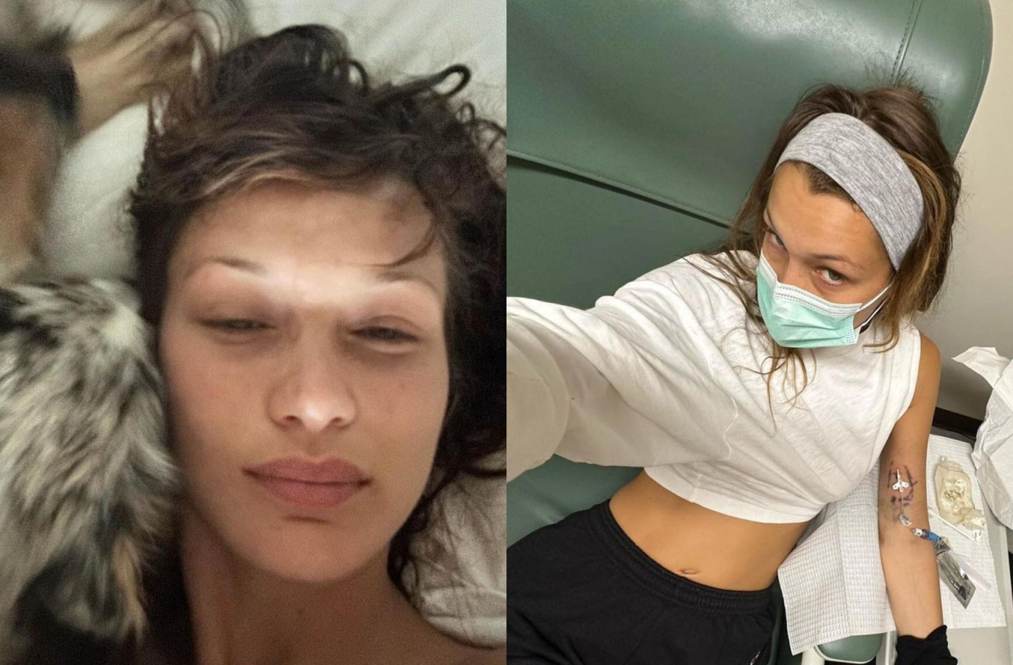 Μπέλα Χαντίντ: Νέες φωτογραφίες από τη θεραπεία της - «Αγνώριστο» το μοντέλο