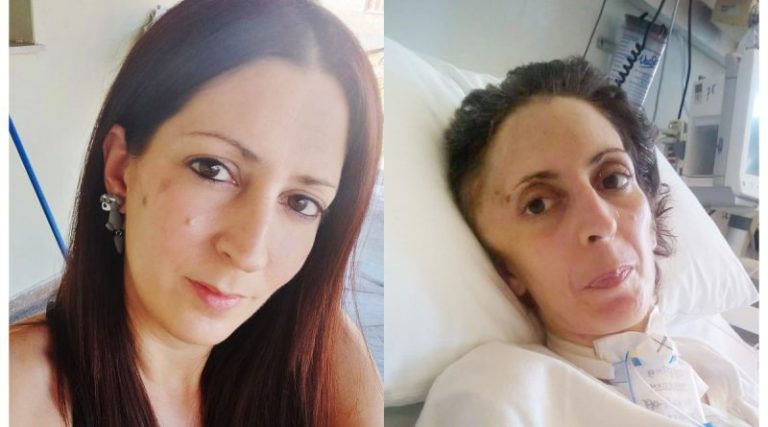 Αργυρούπολη: Πέθανε η 41χρονη Όλγα που κακοποιήθηκε βάναυσα από τον σύντροφό της – Βρισκόταν σε κέντρο αποκατάστασης