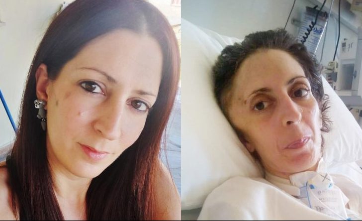 Αργυρούπολη: Πέθανε η 41χρονη Όλγα που κακοποιήθηκε βάναυσα από τον σύντροφό της - Βρισκόταν σε κέντρο αποκατάστασης