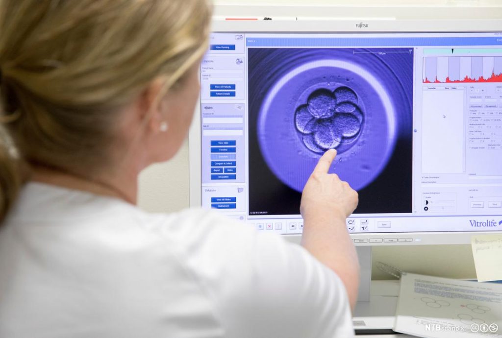 Μεγαλύτερος ο κίνδυνος αιμορραγικού εγκεφαλικού με θεραπείες υπογονιμότητας