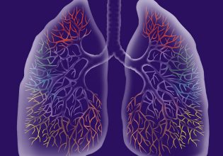 Κλιματική αλλαγή: Τα άτομα με παθήσεις των πνευμόνων αντιμετωπίζουν επιπλέον κινδύνους