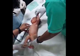 Ινδία: Νεογέννητο βρέθηκε πεταμένο σε αποχέτευση – Αρουραίοι είχαν φάει τα χείλη και τα δάχτυλά του