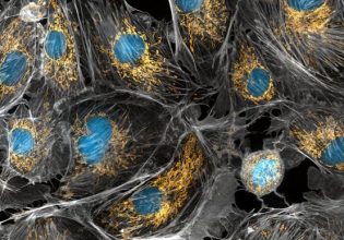 Οι φίλοι που κατάπιαμε: Τα μιτοχόνδρια των κυττάρων μας ίσως προήλθαν από αυτά τα βακτήρια