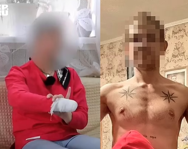 Ρωσία: Έκοψε το χέρι της γυναίκας του με μαχαίρι μπροστά στα μάτια του 5χρονου παιδιού της