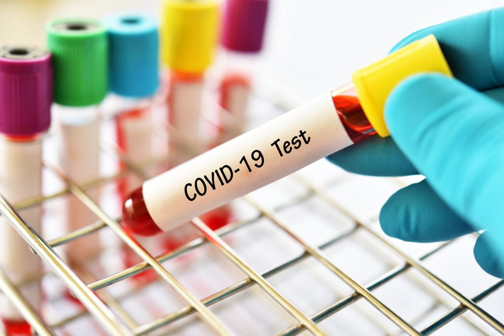 Covid: Τα φάρμακα για τον Covid ίσως προκαλούν τις μεταλλάξεις