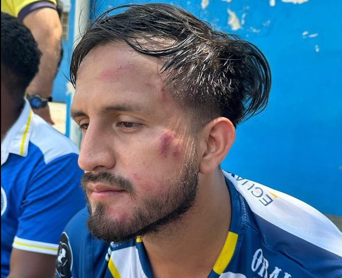 Απίστευτο ξύλο διαιτητή με παίκτη στο Ισημερινό