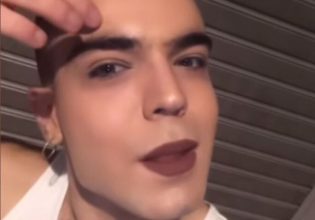 «Έσβησε τσιγάρο πάνω μου, θα γίνω άλλος ένας Ζακ Κωστόπουλος» – Ομοφοβική επίθεση σε queer μοντέλο