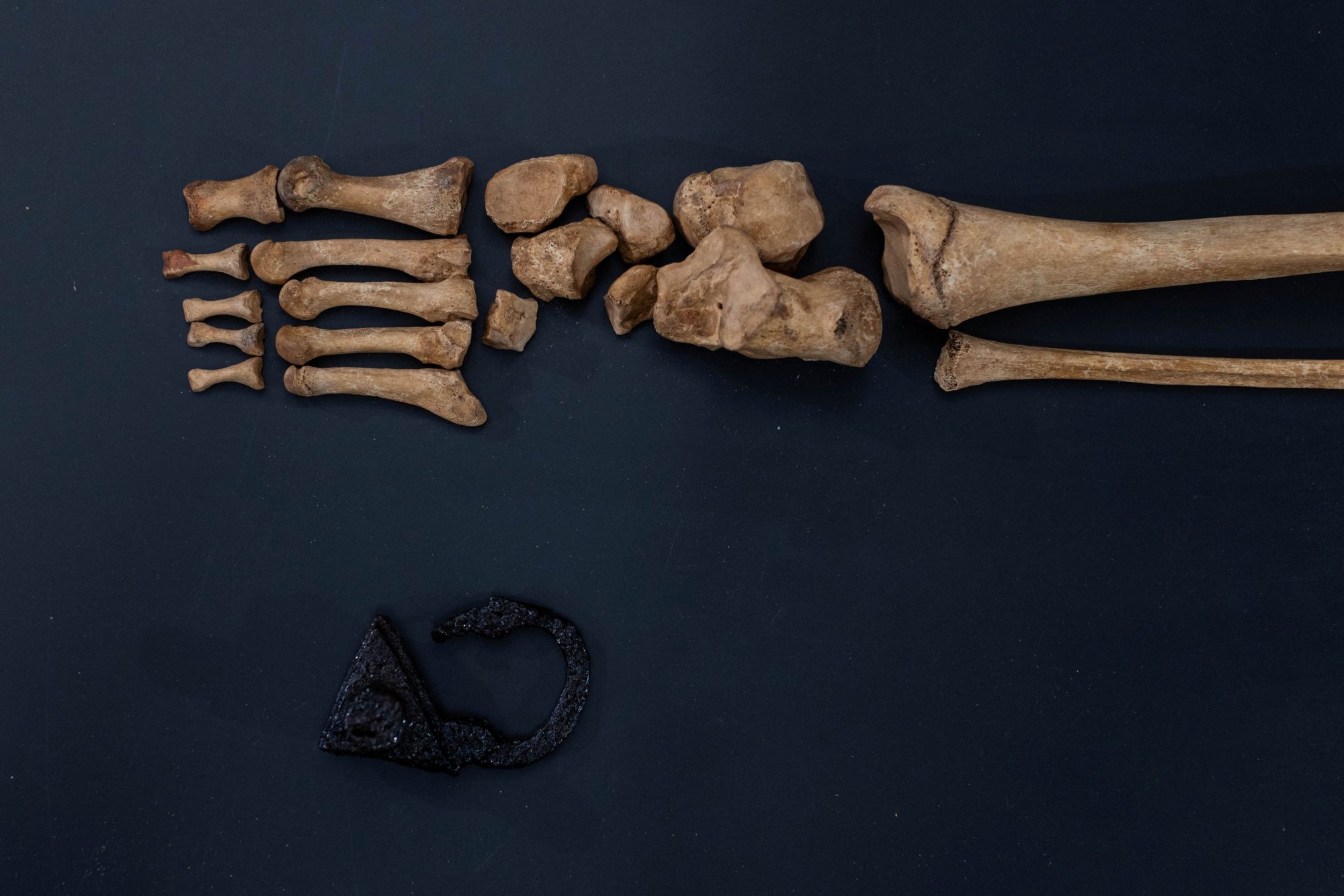 Πολωνία: Τι αποκαλύπτουν τα λείψανα «παιδιού βαμπίρ» - Βρέθηκαν σε τάφο του 17ου αιώνα